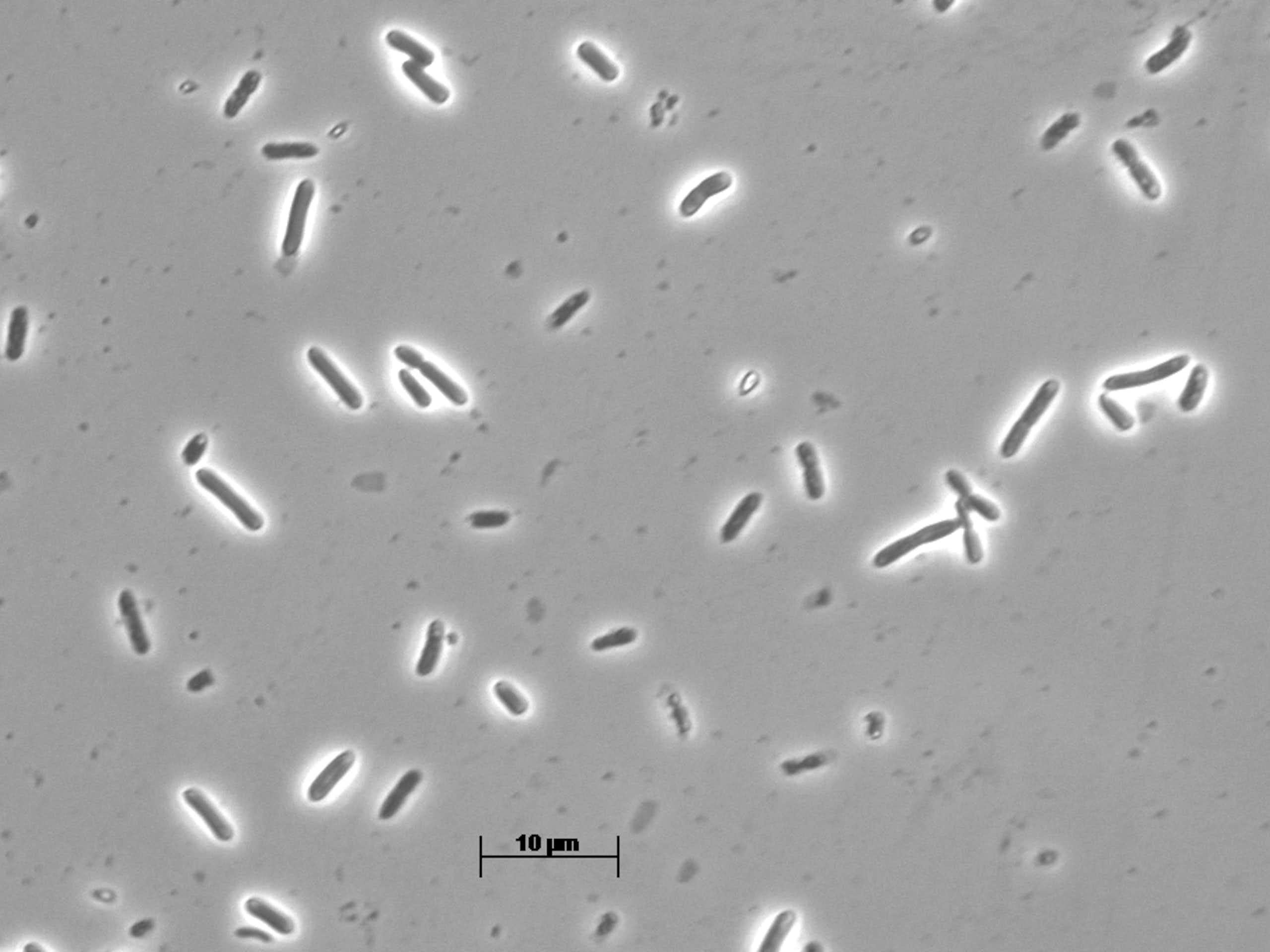 close up of rod-shaped microbes on grey background from microscope